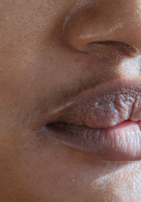 Pimples on Lips or Sensitive Areas: Possible Causes You Should Know