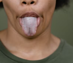 White Tongue: Possible Causes and What It Could Mean