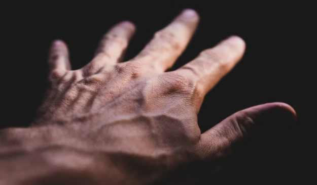 Are Visible Veins in Your Hands Normal? Here’s What to Know
